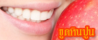 ขูดหินปูน